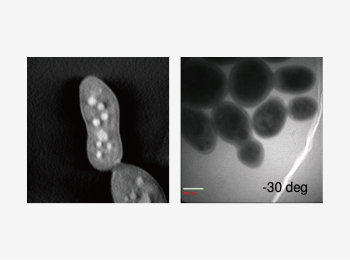 High-resolution imaging